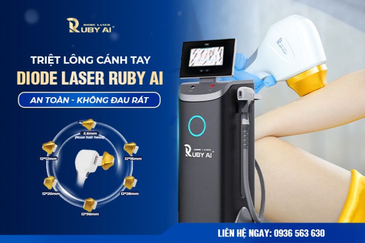 Dịch vụ triệt lông tay công nghệ Dior Laser Ruby AI